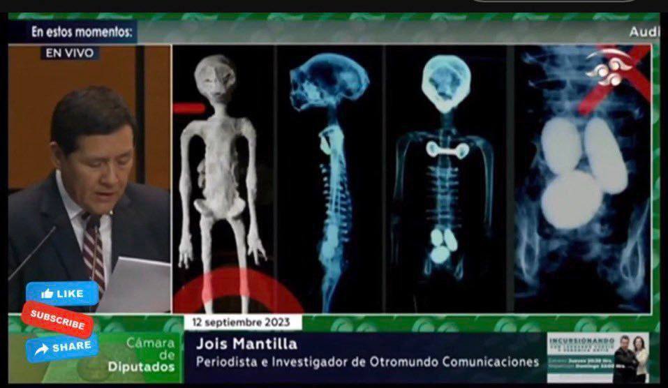 Рентгеновские снимки мумии инопланетянина, найденной в Перу